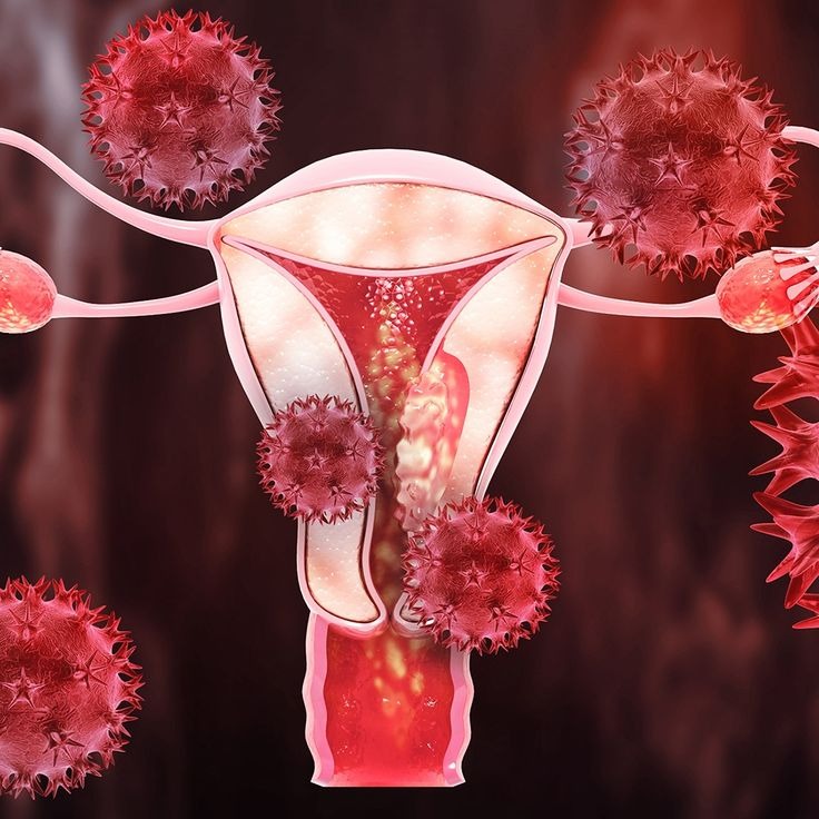 Gastric cancer surgery by expert stomach cancer surgeon