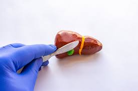 Gallbladder surgery by expert gallbladder surgeon