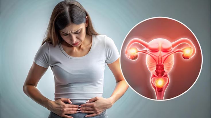 Ovarian cancer staging and diagnosis